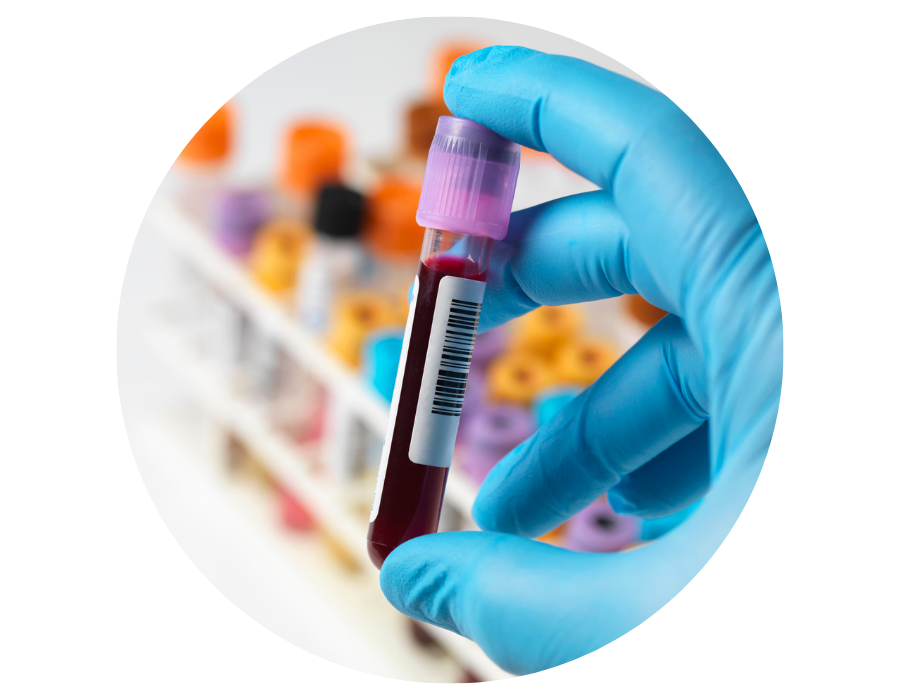 Hand holding blood test vial