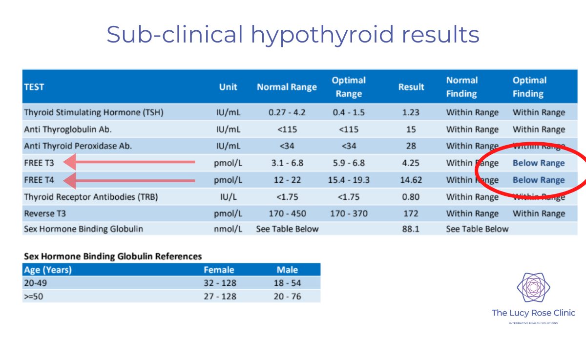 Thyroid and Osteoarthritis: Understanding the Connection