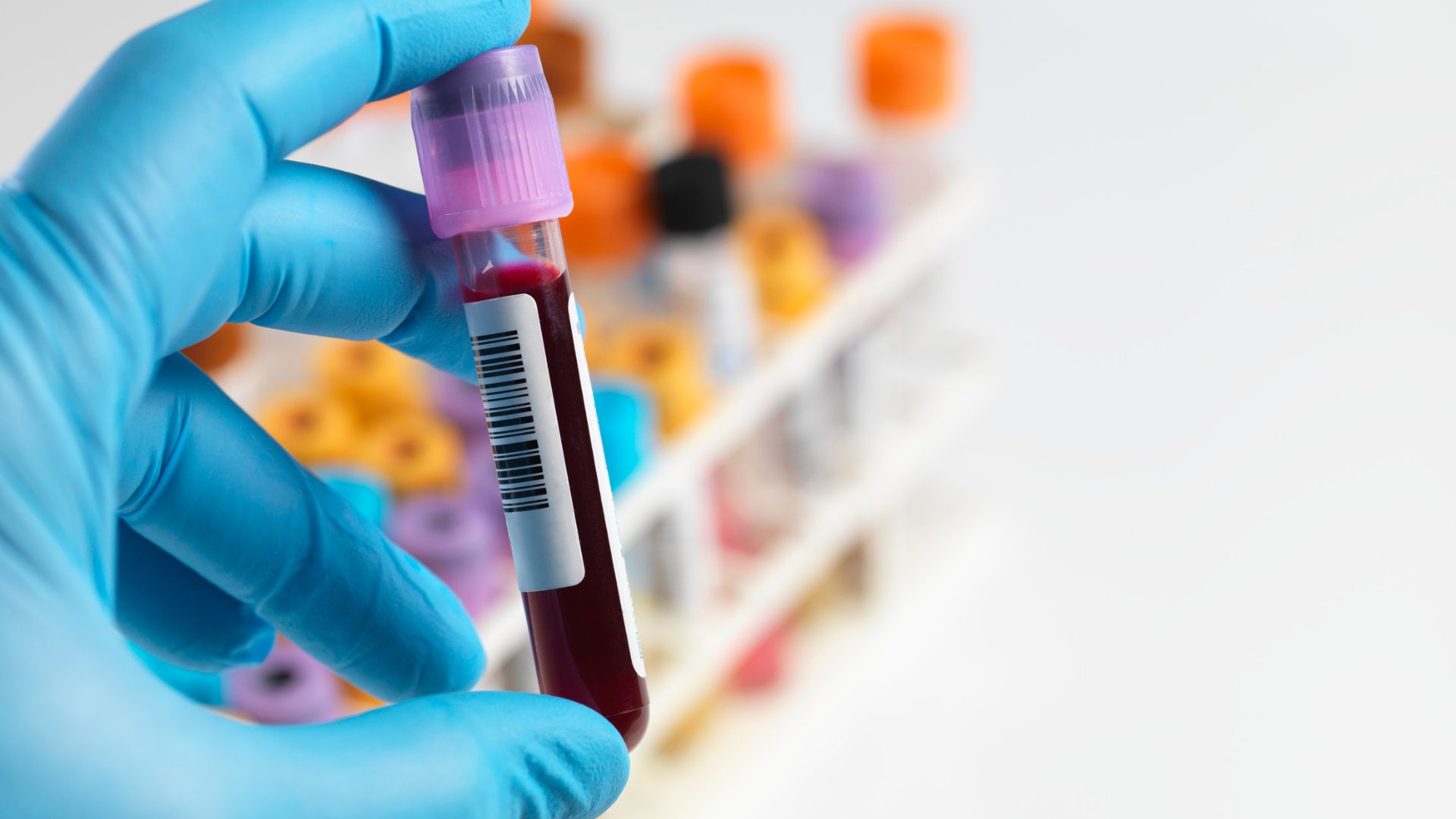 Functional testing overview at The Lucy Rose Clinic